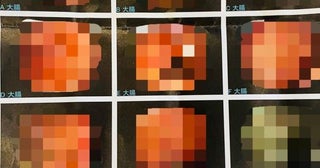 だいたひかるの夫、大腸検査を受けて見つかったものを明かす「大きくなってきたら、切るみたい」