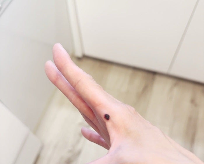 【写真・画像】 高橋真麻、手を負傷したことを報告「どうすることも出来ない…」 　1枚目