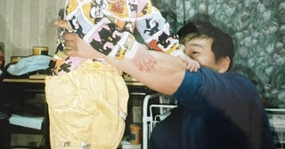 表皮水疱症の子どもにとって命取りになること「脇の皮が剥けてしまって大泣き」