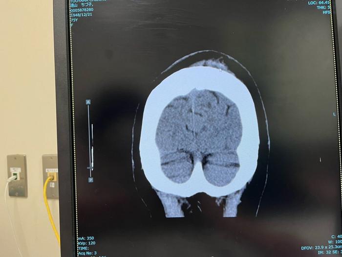 【写真・画像】 あいのり・桃の母、後頭部を強打し脳神経外科でCT検査を受けた結果「夫が心配していろいろ電話して」 　1枚目