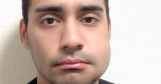 ネイボール、親知らずを抜いた後の自身の姿を公開「こぶとりじいさんみたいですよね」