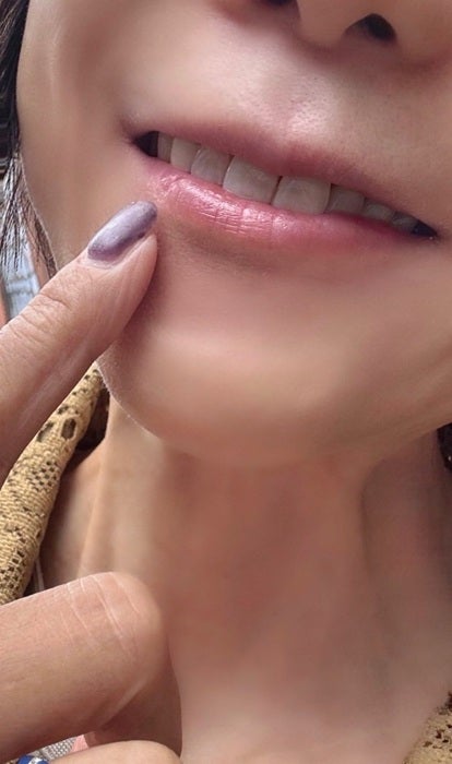 【写真・画像】 堀ちえみ、ホワイトニング後の歯を公開「自然な白さになって嬉しい」 　1枚目