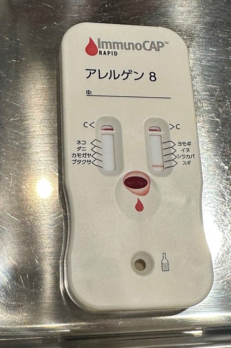 【写真・画像】 あぢゃ「可哀想」長男の様子が気になり眼科で検査を受けた結果「血をとって30分くらい待ったら」 　1枚目