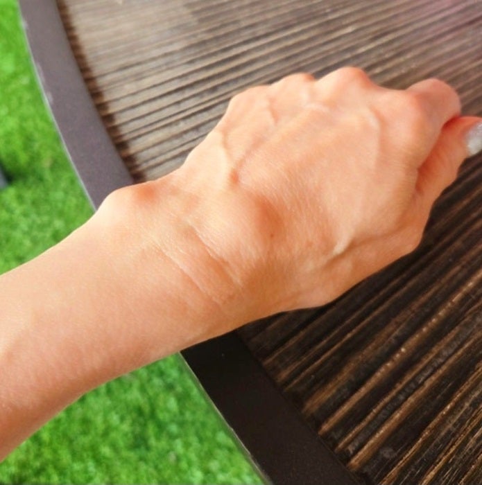 【写真・画像】 モト冬樹「大丈夫かな？」妻・武東由美の手の甲に現れた症状「付き添って整形外科で切開手術をしたこともある」 　1枚目