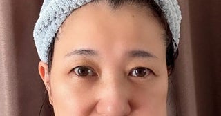 新田恵利、親知らずを抜いた後の自身の姿「痛そう」「お大事に」の声