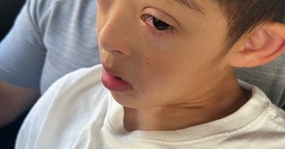 ラミレスの妻、異変を感じていた子ども達の目の様子「真っ赤。感染するから欠席です」