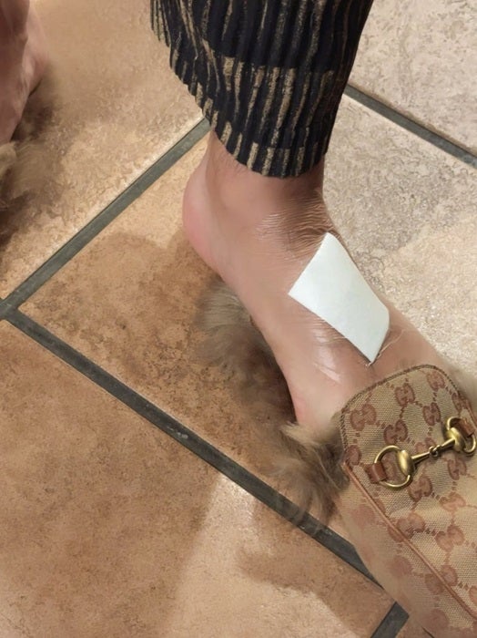 【写真・画像】 川崎希、夫・アレクが負傷し再度病院を受診した結果「綺麗に治るといいな。。。」 　1枚目