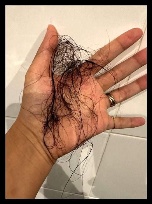 【写真・画像】 ギャル曽根、抜け毛が5か月続くと確実に無くなる髪の毛「育毛剤や、漢方も調べてみます」 　1枚目
