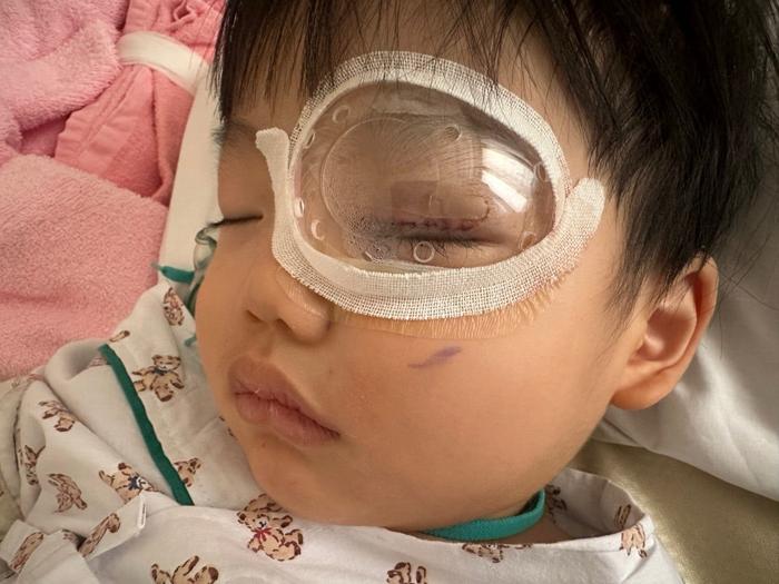 【写真・画像】 あいのり・桃、眼瞼下垂の手術を終えた次男の様子を報告「状況にびっくりして大泣きして」 　1枚目