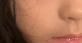 相沢まき、目の下が腫れた娘を連れて眼科を受診した結果「しこりが残る可能性が高く、3～4ヶ月は残るかも」