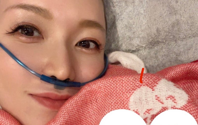 【画像】チューブを鼻につける居原田麗さん
