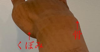だいたひかる、リンパ浮腫の手術のビフォーアフターを公開「凄い」「よくなってる！」の声