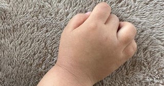 はあちゅう氏、早めに受けていた息子の異所性蒙古斑の治療「成長後も消えない可能性」