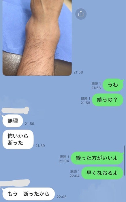 【写真・画像】 川崎希、夫・アレクが負傷し急いで病院を受診「10件目くらいに電話して」 　1枚目