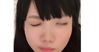 ウイルスにより発症した顔面麻痺「軽く触れただけで嘔吐するほどの激痛」
