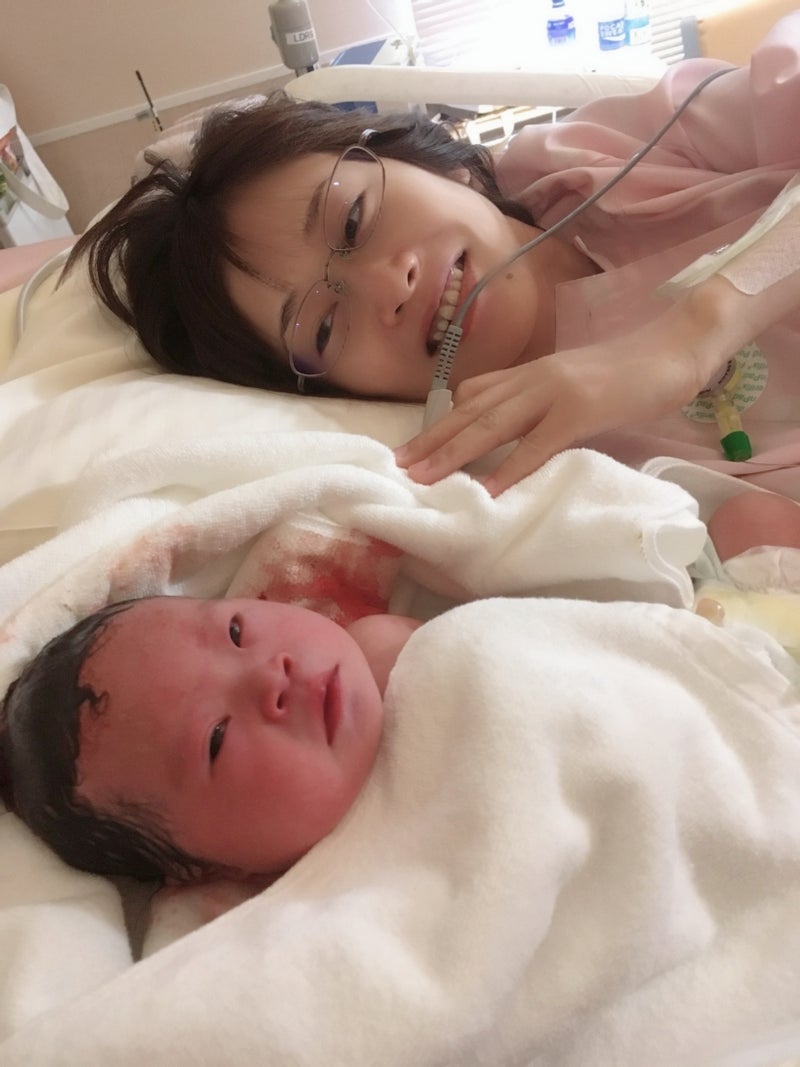 21トリソミー診断受けた子の出産「赤ちゃんが苦しそうです」 - Ameba News [アメーバニュース]