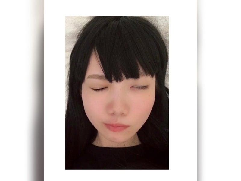 【画像】右目を閉じられなかった井上さあやさん