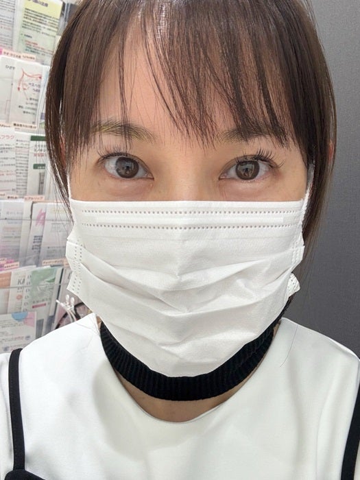 【写真・画像】 上原さくら、眼瞼下垂の手術を受けたことを報告「たるみを直したよ！」 　1枚目