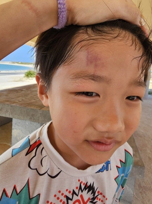 【写真・画像】 小原正子、沖縄の海で顔面を怪我した次男「痛々しい」「お大事に」の声 　1枚目